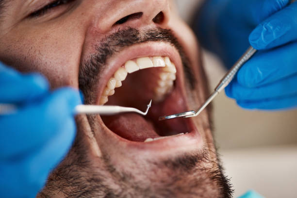 Best Emergency Dental Care for Sports Injuries in Nescopeck, PA